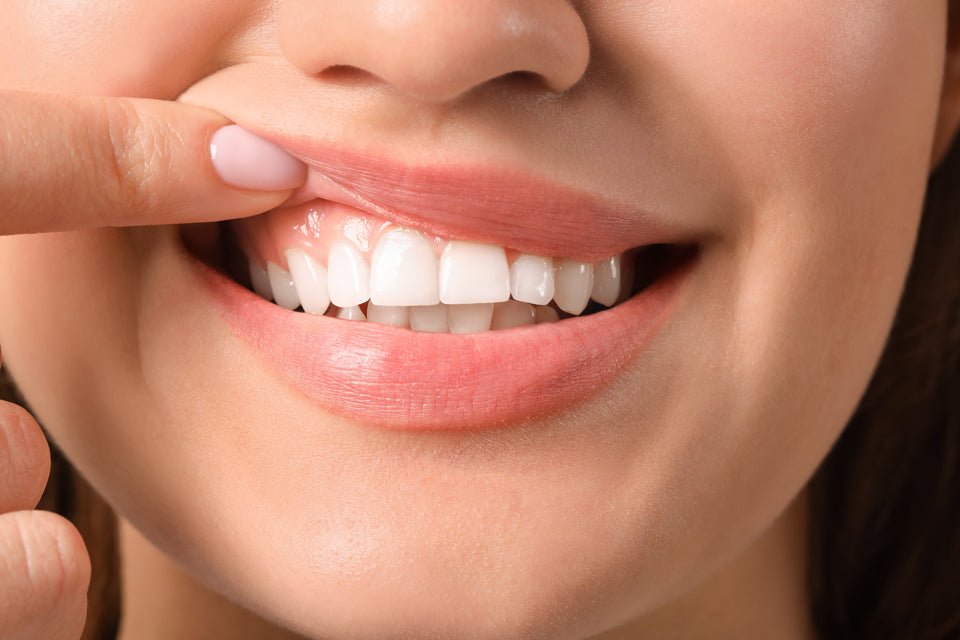 Gingivitis Treatment: Heal Your Gums & Keep Them Healthy - SOLO 7